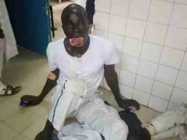 Viewer Discretion:- Man Killed By His Own Brother After Fighting Over A Piece Of Land (Graphic Photos)